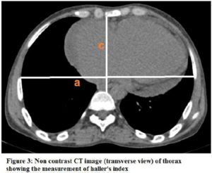 145020-fig-3