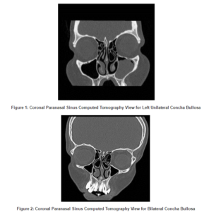 260913-fig-1,2