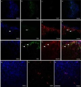 Differentiation of NPs and MSCs