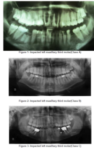 486120-fig-1,2,3