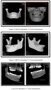 798969-fig-3a,3b,3c